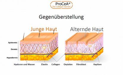 A diagram showing the difference between junge haut and alternde haut