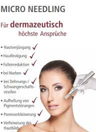 Eine Frau bekommt eine Mikronadelbehandlung im Gesicht.