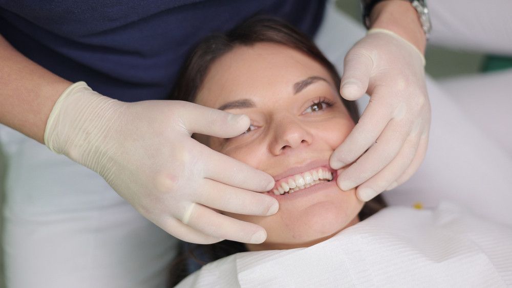 veneers