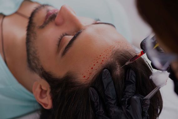 A man is getting a hair treatment in his head.