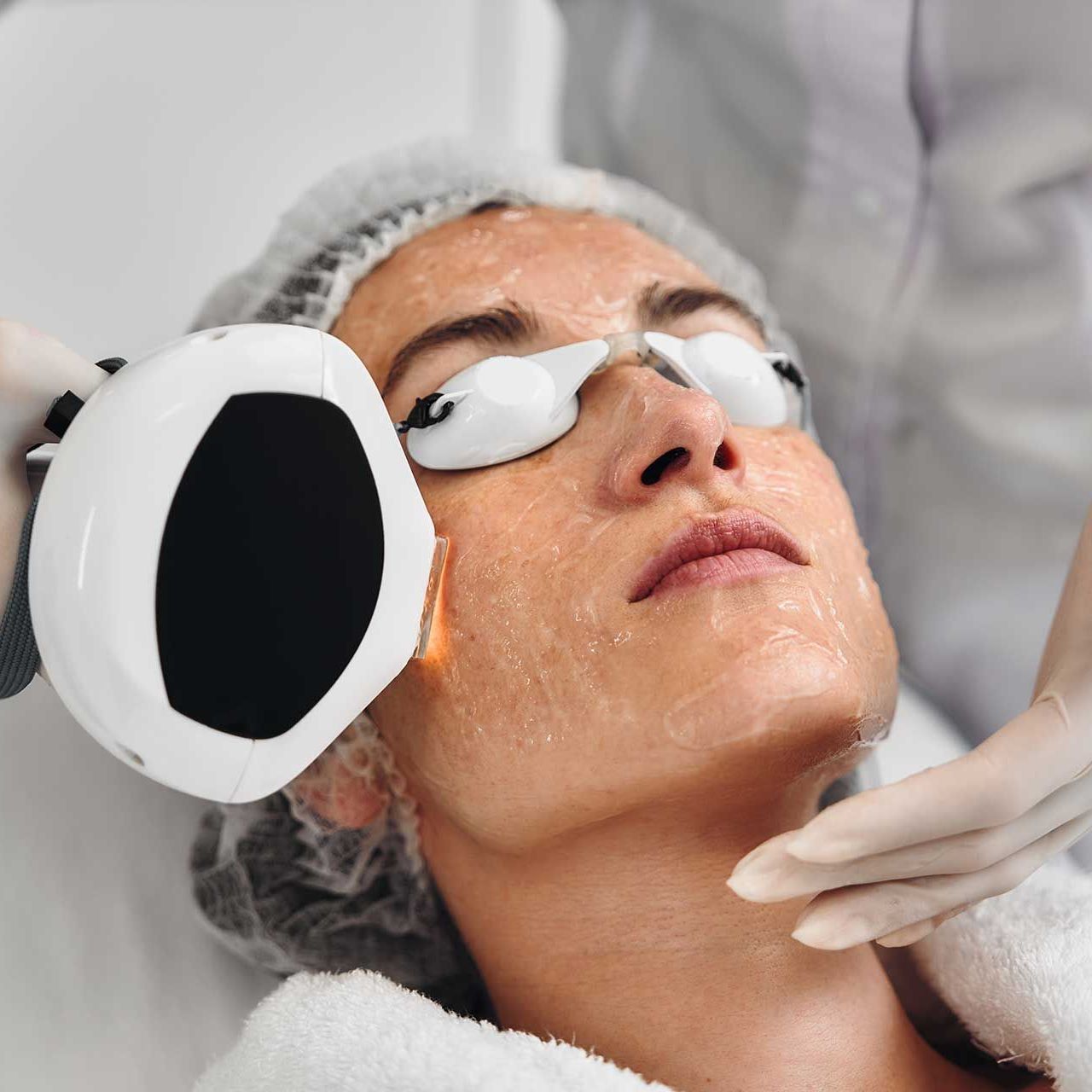 A woman receives IPL therapy in a beauty salon.