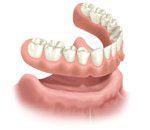 False teeth, the top row against a pink upper gum and the bottom row on a lower gum.
