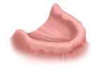 Pink, fleshy object; likely a human inner ear structure, shown in a close-up view.