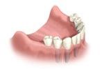 An illustration of human teeth in the lower jaw.
