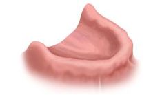 Illustration of a pink upper denture, highlighting its shape and contours.