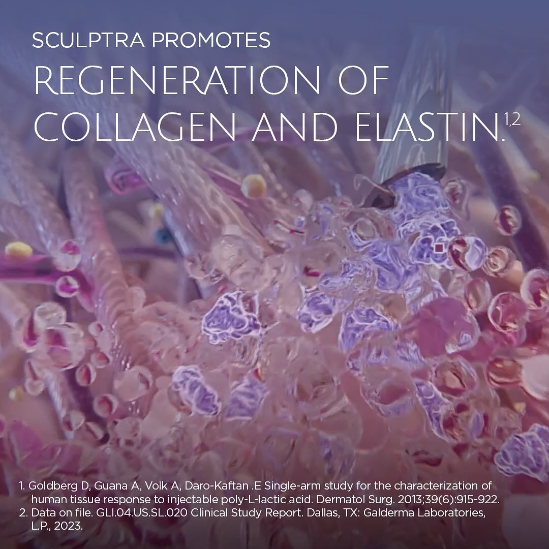 Sculptra promotes regeneration of collagen and elastin
