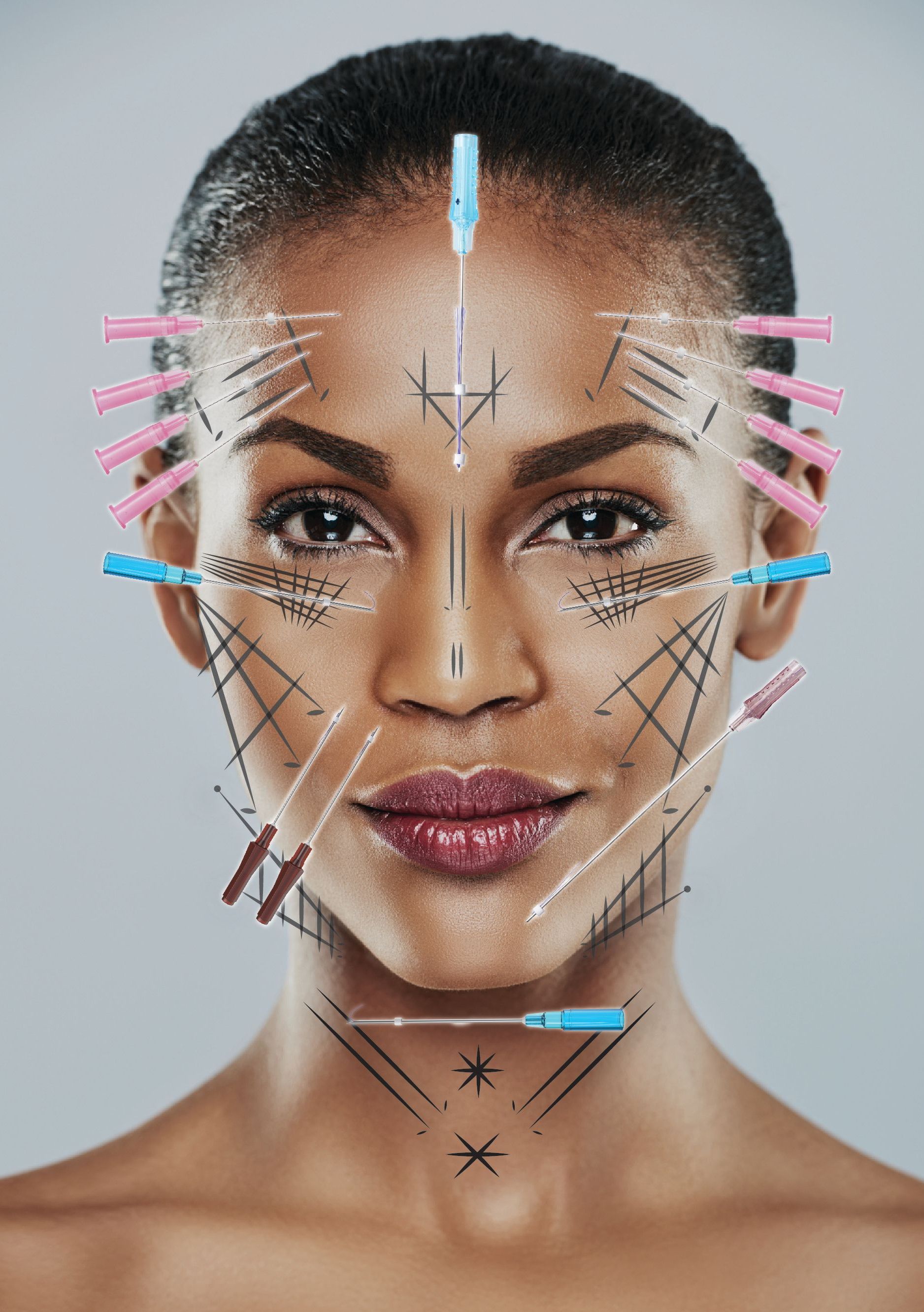 Dermal Filler Treatment