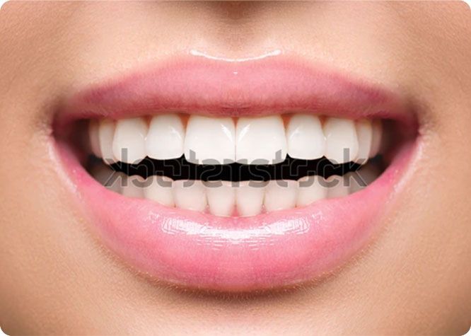 Close-up of smiling mouth, showing bright white teeth and pink, glossy lips.