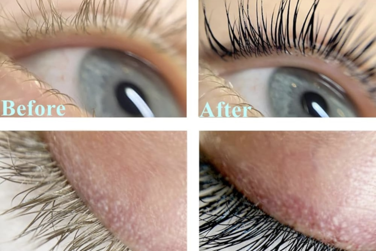 Before-and-after close-up of an eyelid and lashes, showing fuller, darker eyelashes after treatment.