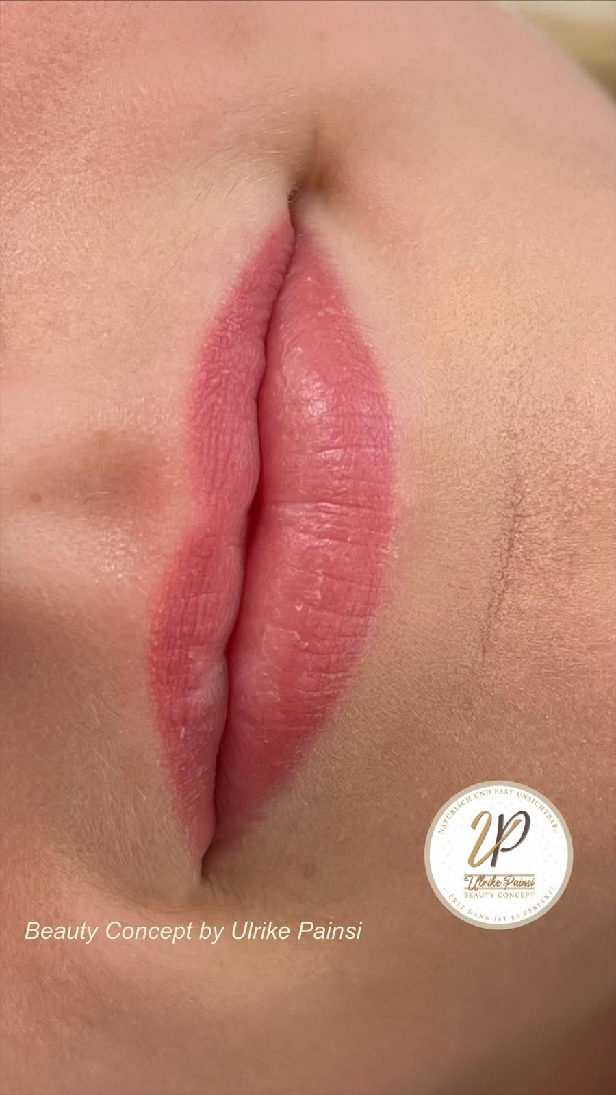 Vorher-Nachher-Nahaufnahme der Lippen