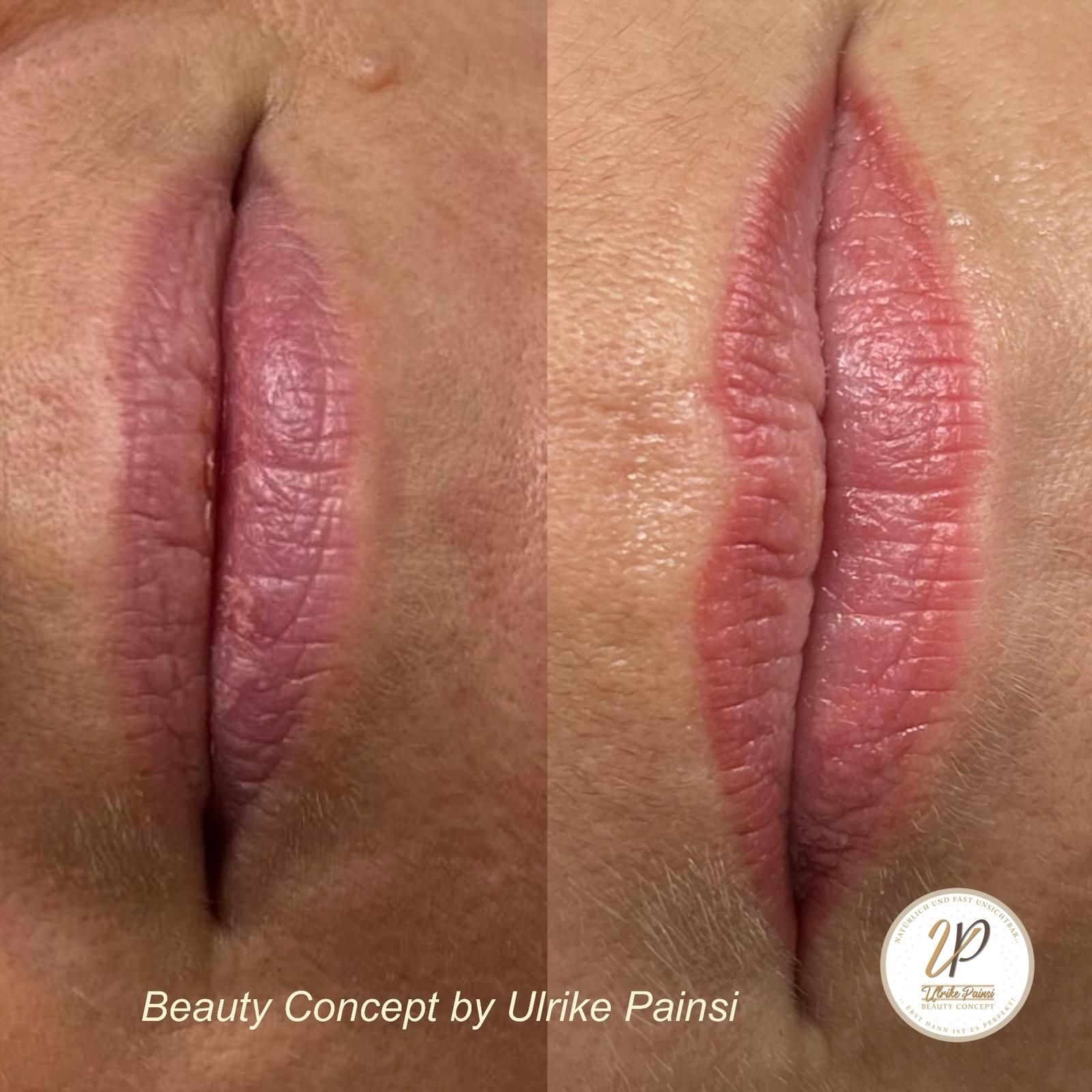 Nahaufnahme von rosafarbenen, glänzenden Lippen mit sichtbarer Lippenfüller-Symmetrie vor einem neutralen Hautton.