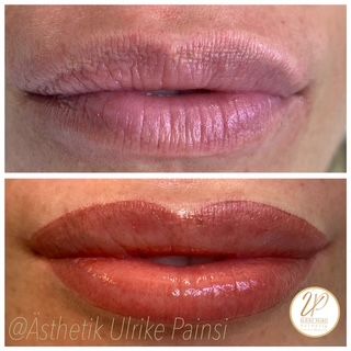 Vorher-Nachher-Nahaufnahme der Lippen