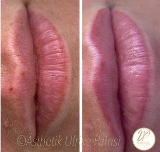 Nahaufnahme vor und nach der Veränderung von pinkfarbenen, glänzenden Lippen 