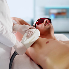 Eine Person, die sich in einer Klinik einer Laserhaarentfernung an der Brust unterzieht.