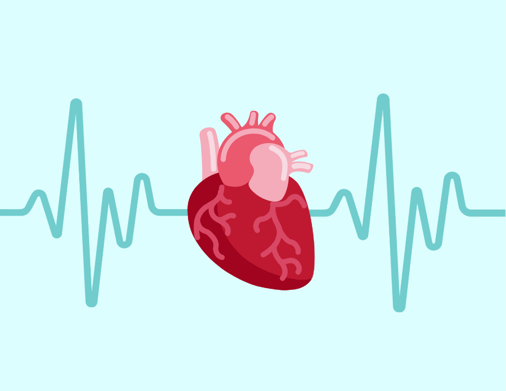 Holter Monitoring