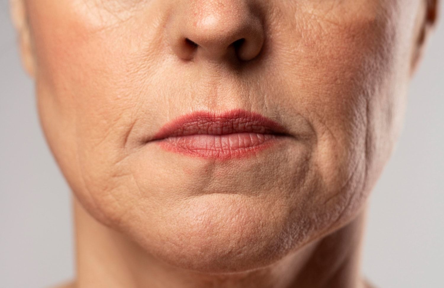Facial Rejuvenation, Cornwall, Elapromode