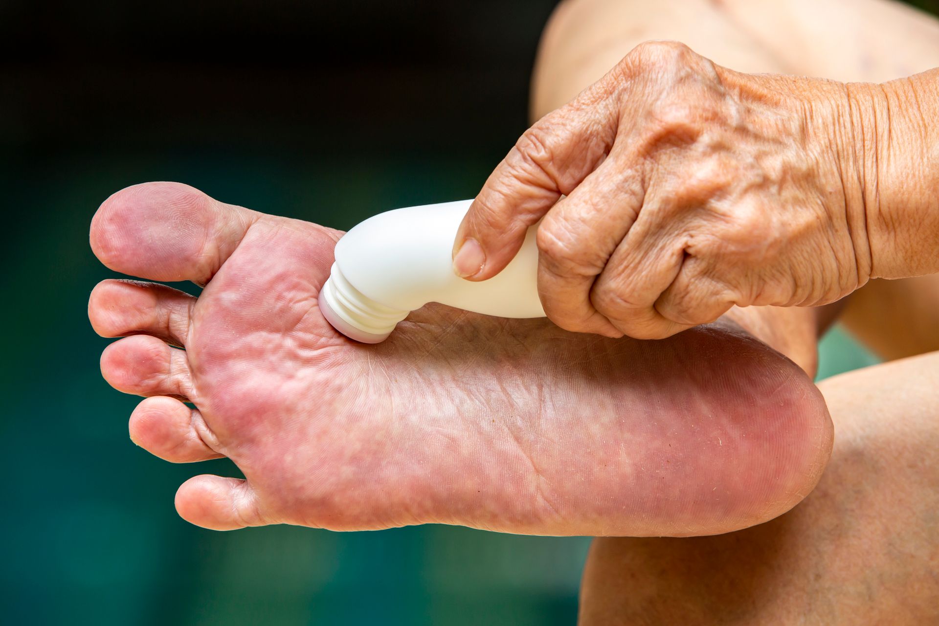An elderly woman is applying lotion to her foot.