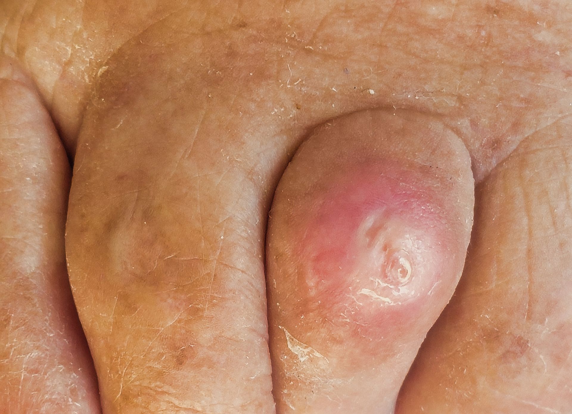 A close up of a person 's finger with a red spot on it