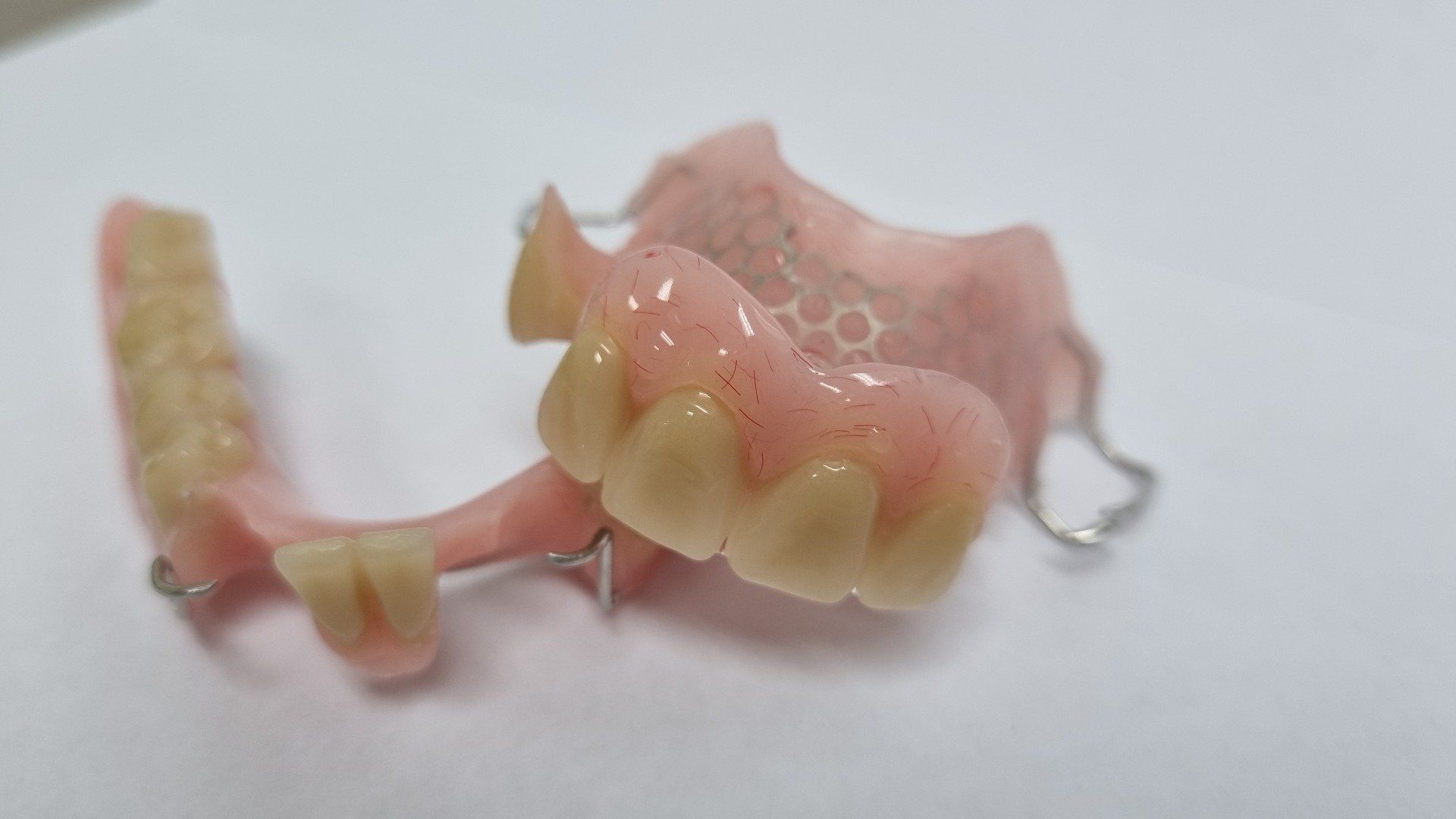 Partial Denture — The Denture Care Group Sunshine Coast in Caloundra, QLD