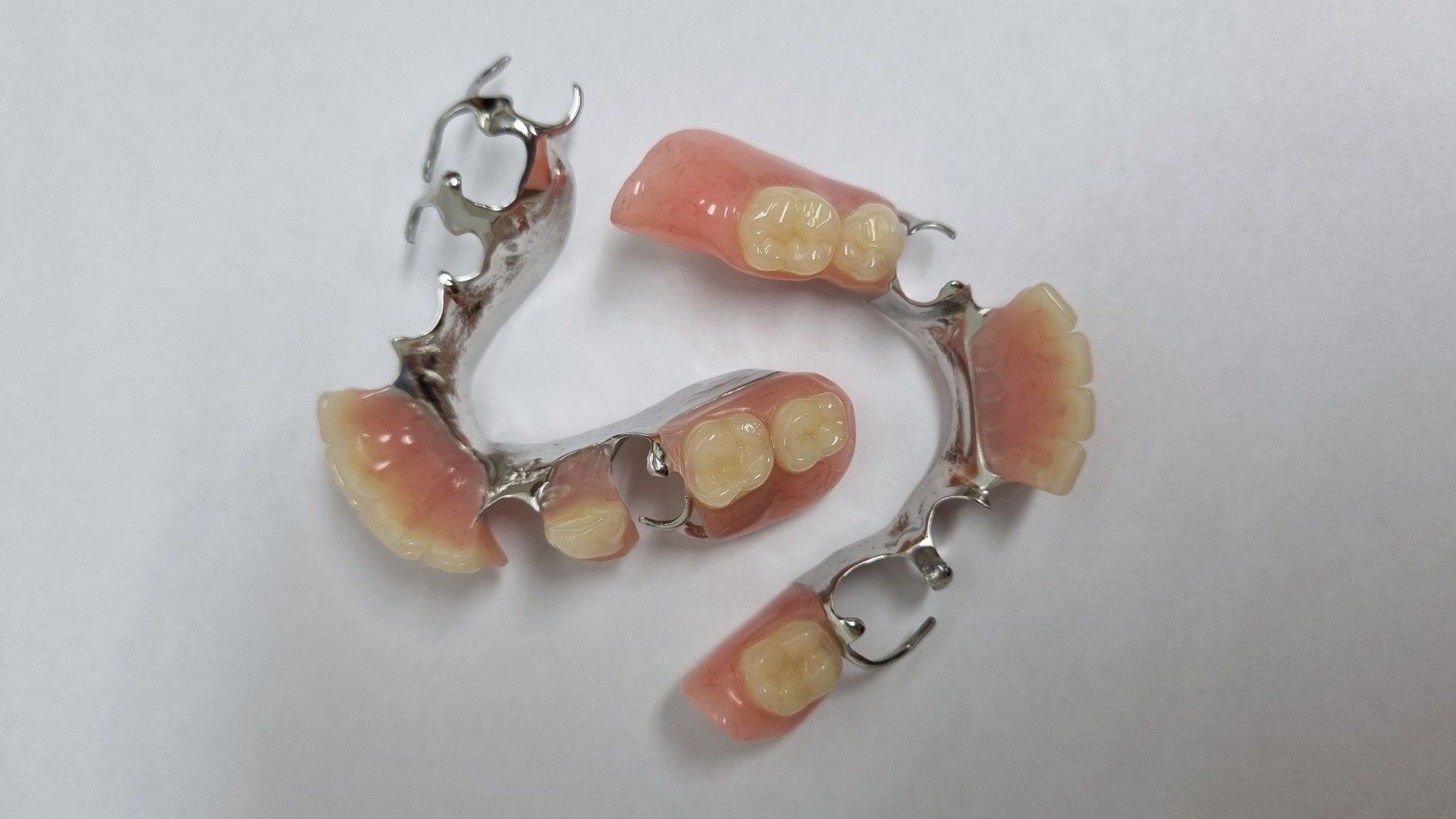 Down Side Partial Denture — The Denture Care Group Sunshine Coast in Caloundra, QLD