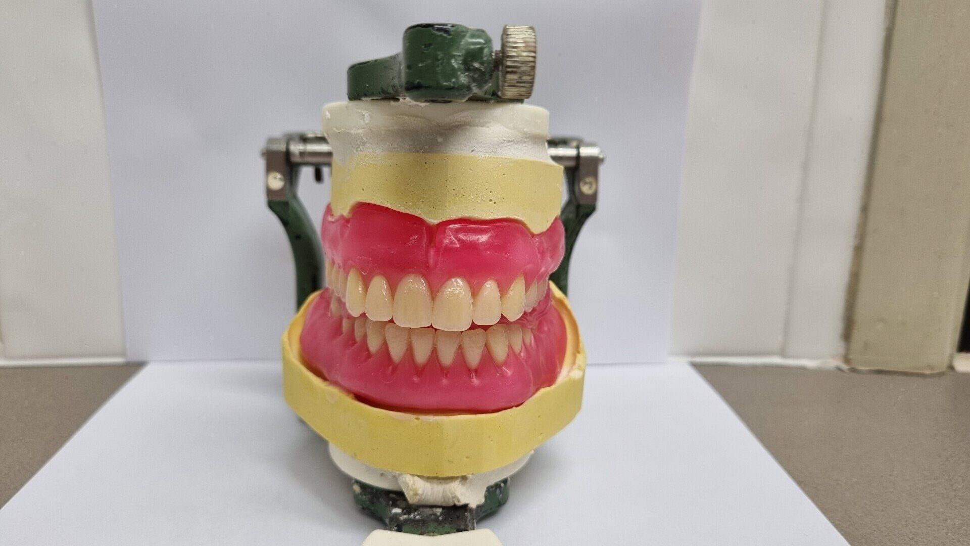 Denture  Making — The Denture Care Group Sunshine Coast in Caloundra, QLD