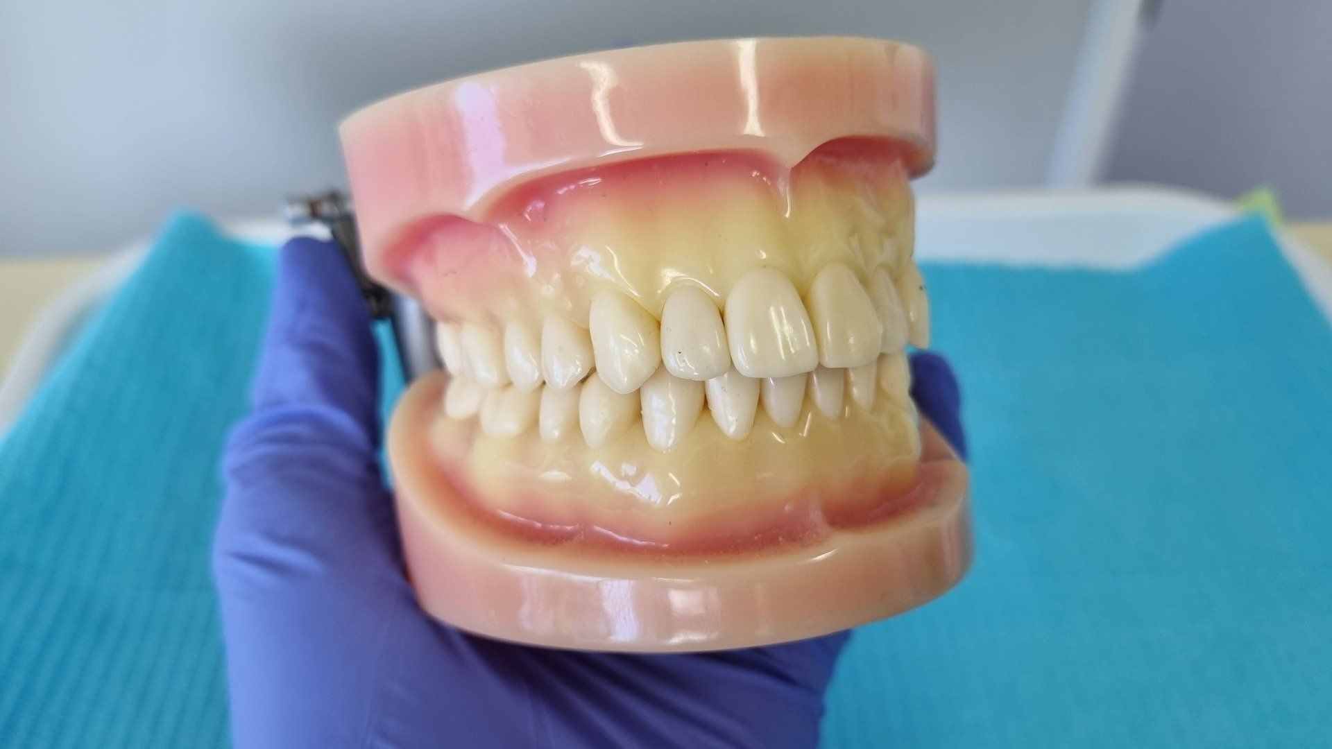 Dentist Hand With Medical Rubber Glove Holding Removable Partial Denture — The Denture Care Group Sunshine Coast in Maleny, QLD