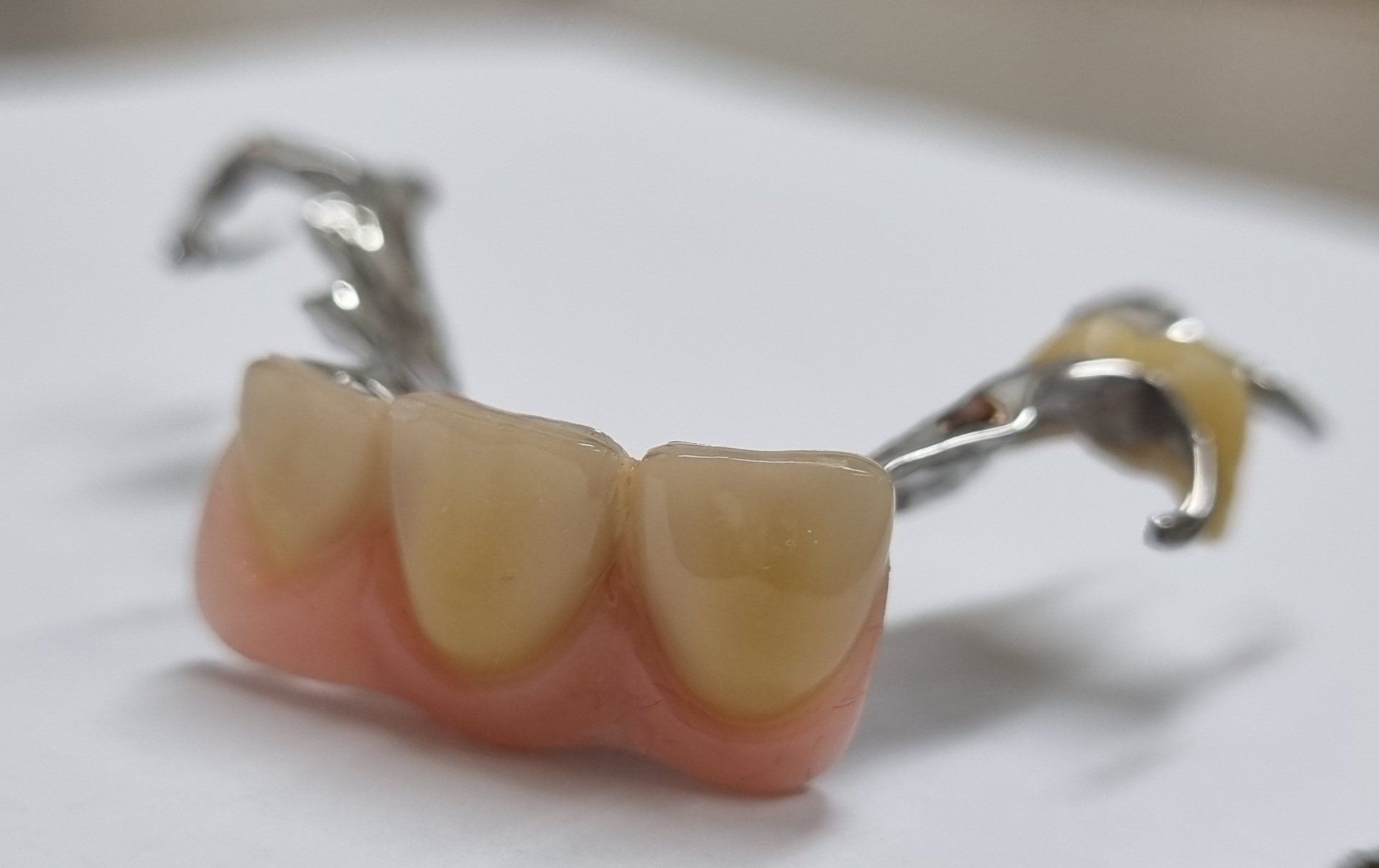 Denture  Repair — The Denture Care Group Sunshine Coast in Caloundra, QLD