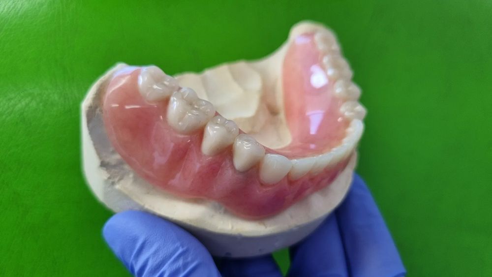 A Denture Maintenance — The Denture Care Group Sunshine Coast in Caloundra, QLD