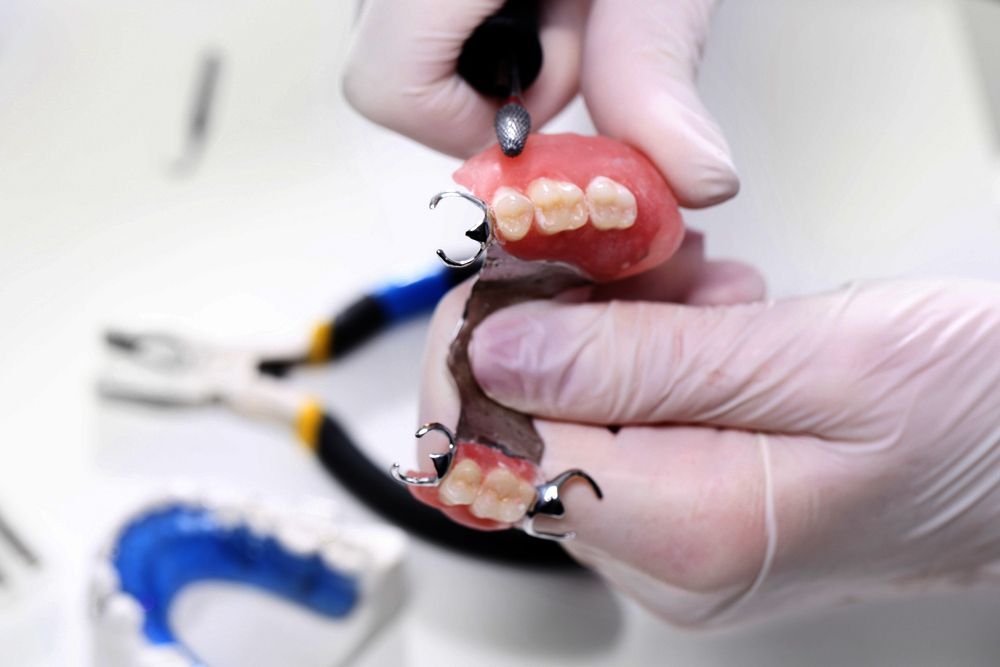 A Professional Denture Repair — The Denture Care Group Sunshine Coast in Caloundra, QLD