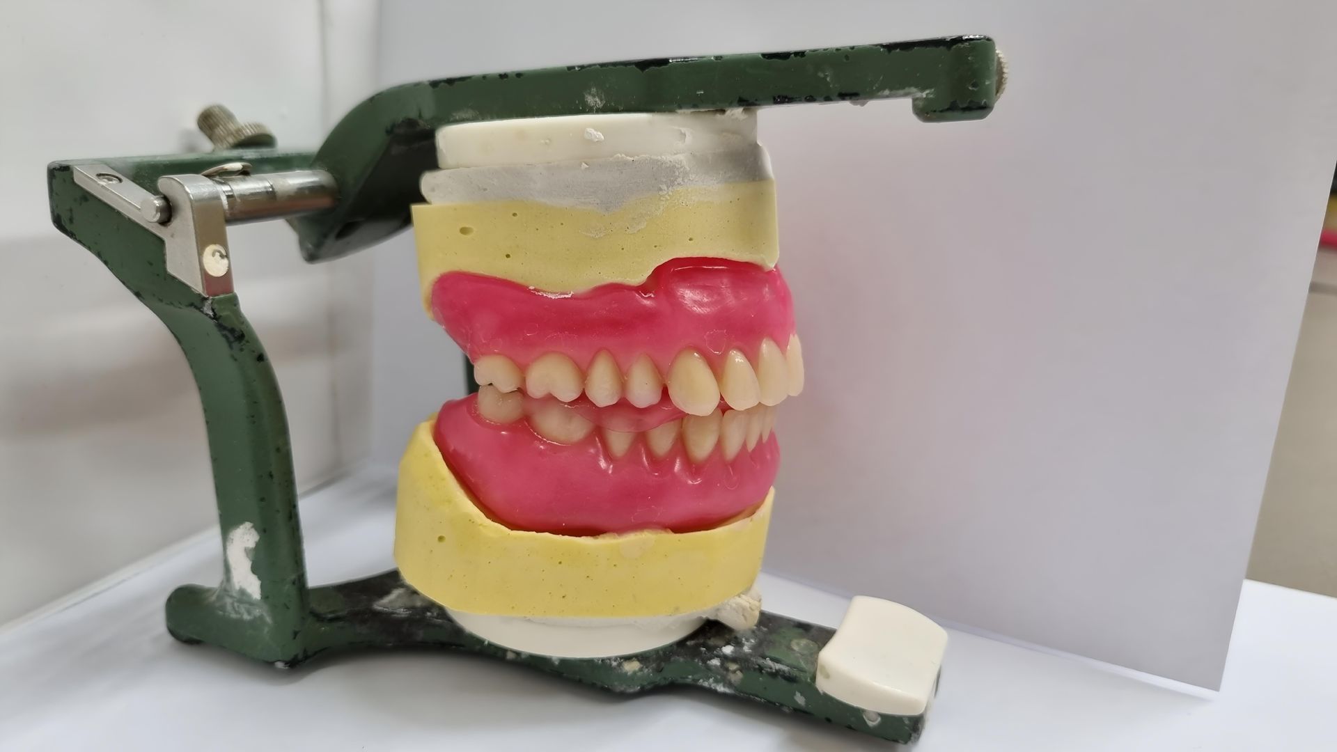 Dental Model — The Denture Care Group Sunshine Coast in Caloundra, QLD