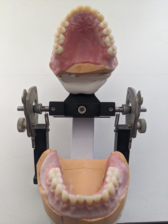 Denture Reline — The Denture Care Group Sunshine Coast in Caloundra, QLD