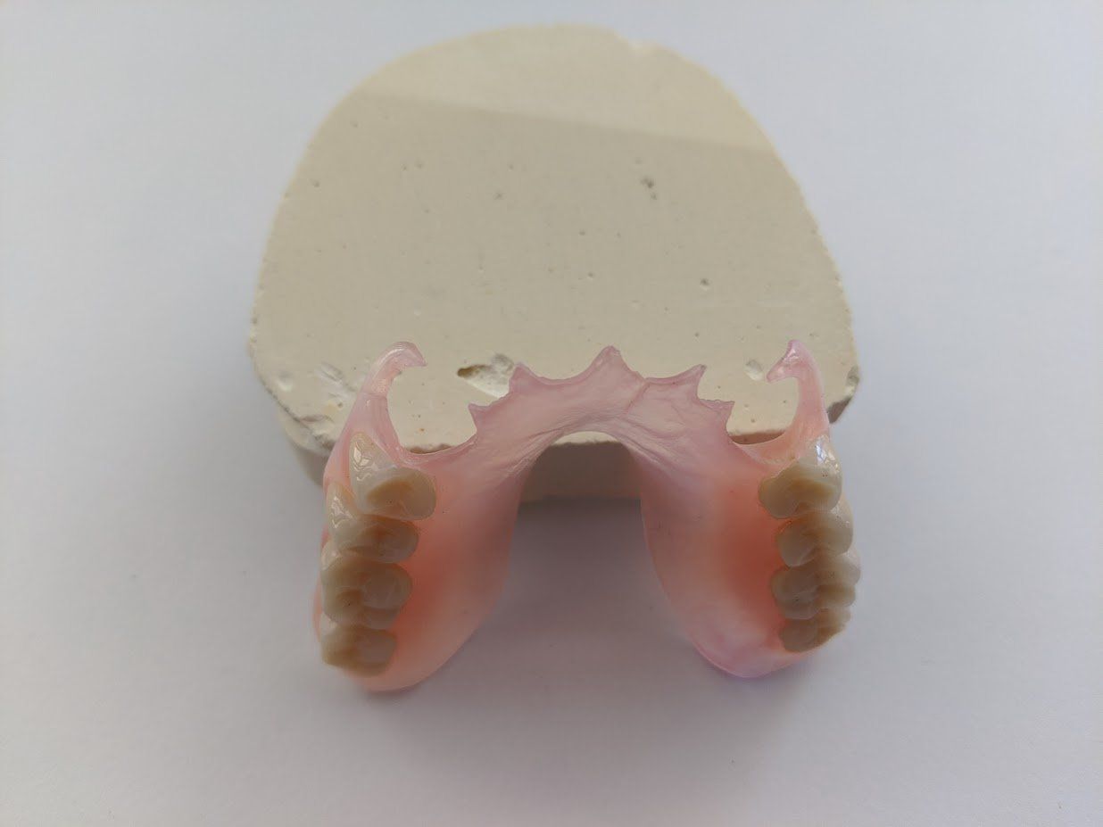Close Up Of Dentist With Tooth Color Samples — The Denture Care Group Sunshine Coast in Caloundra, QLD