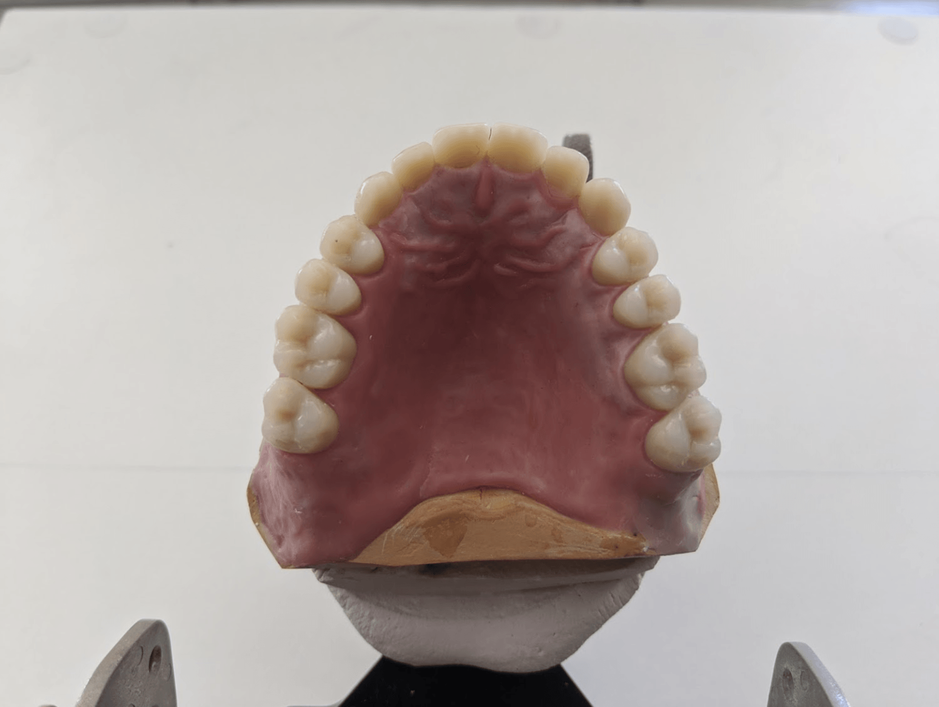 Upper Dental Arch Model — The Denture Care Group Sunshine Coast in Caloundra, QLD