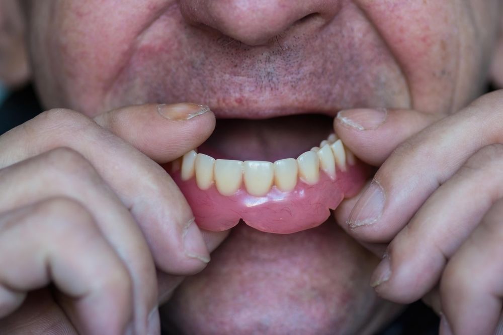 Person Holding a Set of Dentures — The Denture Care Group Sunshine Coast in Caloundra, QLD