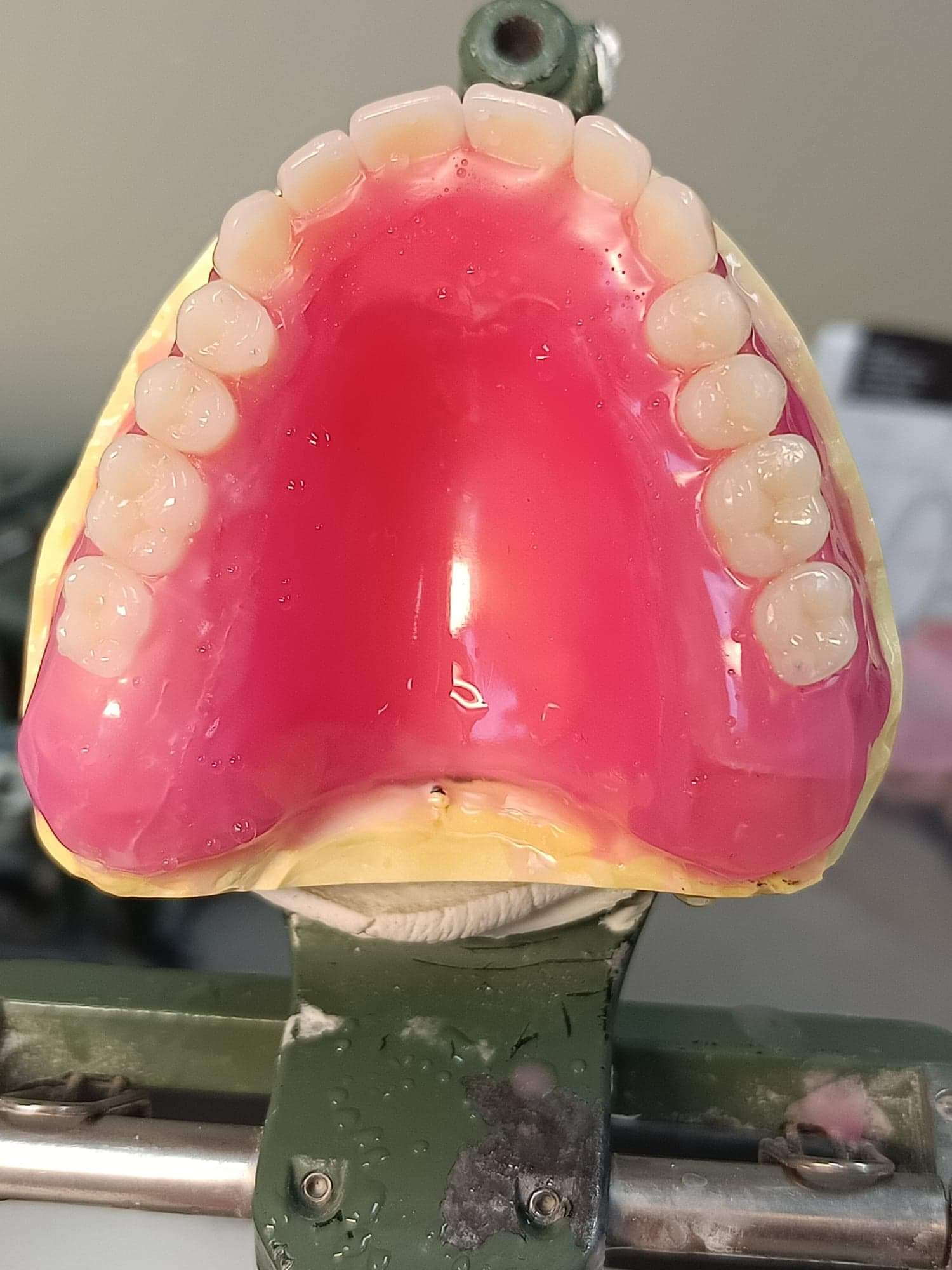 Best Denture Picture With The Focus On Teeth — The Denture Care Group Sunshine Coast in Caloundra, QLD