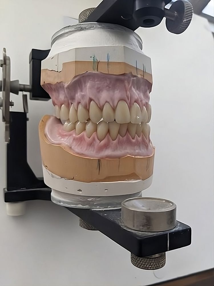 Dentist Checking New Dentures — The Denture Care Group Sunshine Coast in Maleny, QLD
