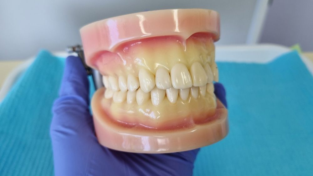 Dentist Holding a Molding of Teeth — The Denture Care Group Sunshine Coast in Caloundra, QLD