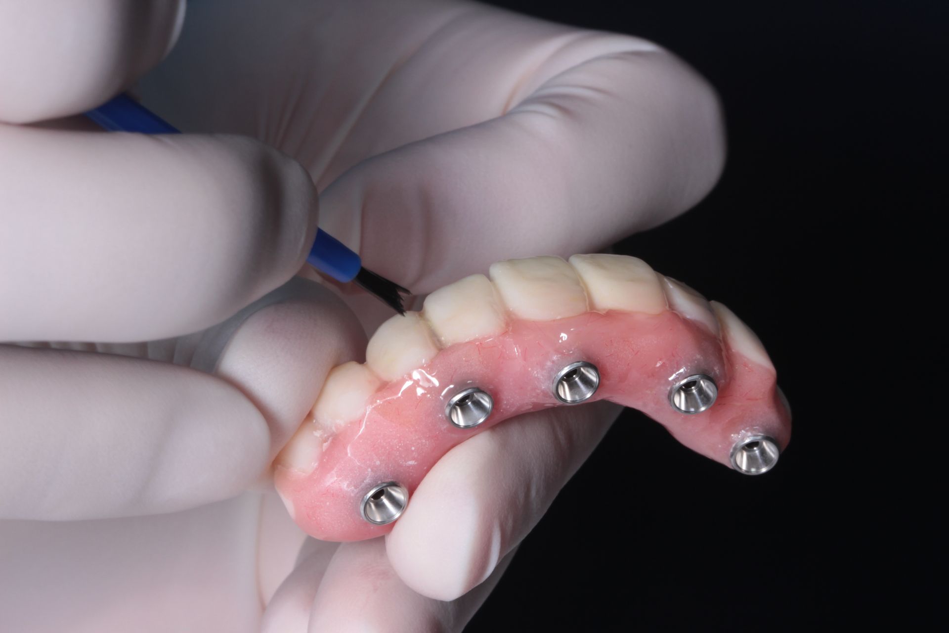 Close-up of a Hand With a Gloved Hand Holding a Dental Implant Bridge — The Denture Care Group Sunshine Coast in Caloundra, QLD