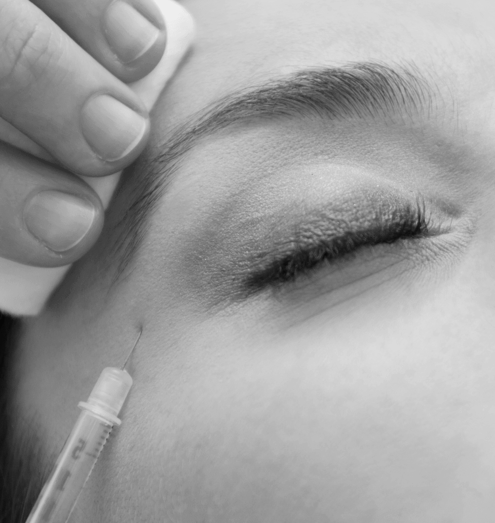 INJECTIONS BOTOX PATTES D'OIE Genève Champel