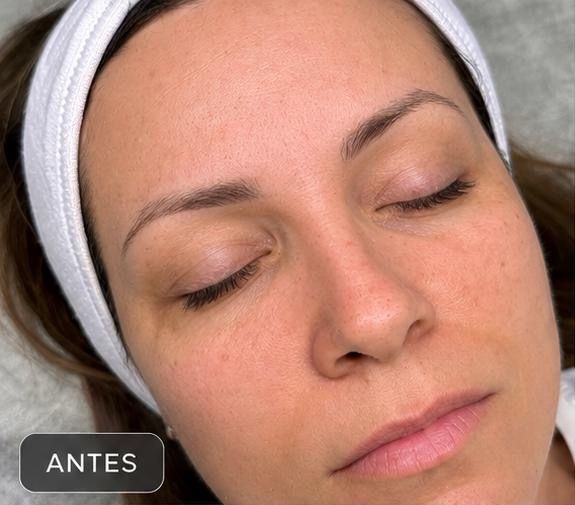 Before microblading at Hairdoctors The Crossings