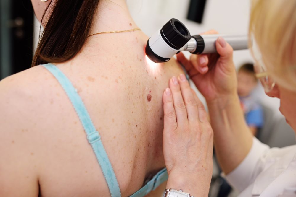 Doctor Examining a Patient Upper Back with A Dermatoscope in A Clinic — Rainbow Beach General Practice in Rainbow Beach, QLD