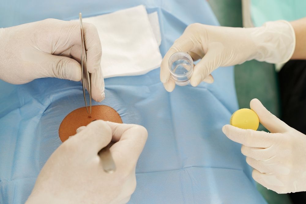 Gloved Hands Performing a Surgical Procedure on A Patient — Rainbow Beach General Practice in Rainbow Beach, QLD