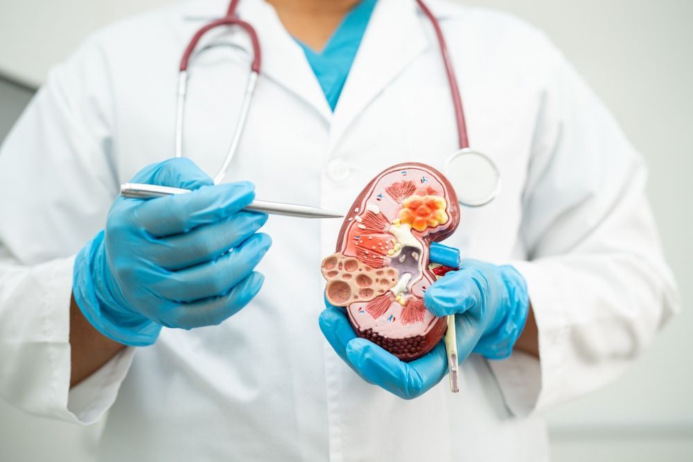 Doctor Holding a Kidney Cross Section Model with Surgical Tools — Rainbow Beach General Practice in Rainbow Beach, QLD