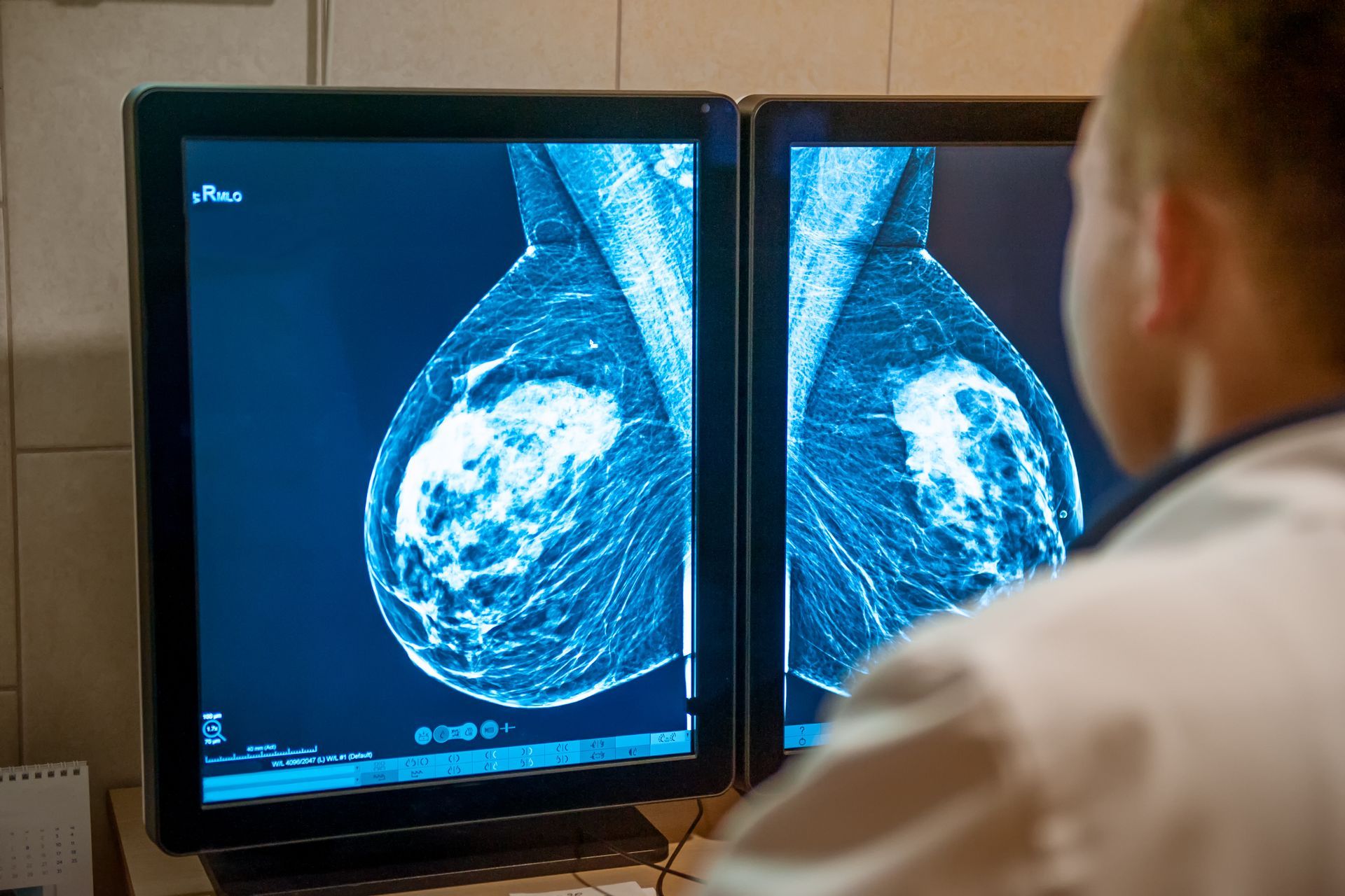 A doctor is examining a mammogram snapshot. A doctor is examining a mammogram snapshot.