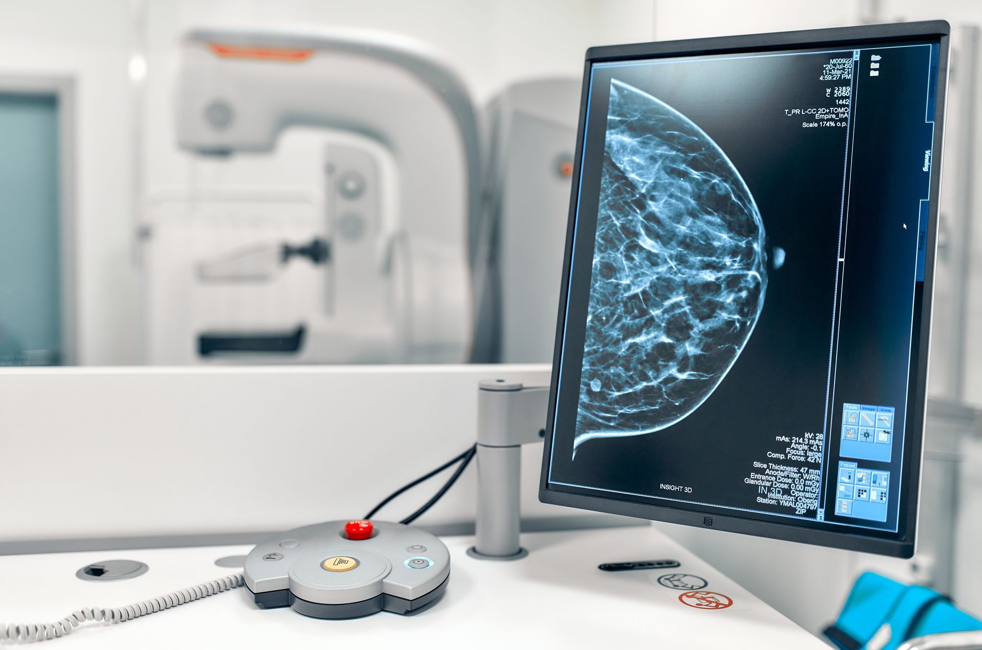 Mammogram snapshot of breasts of a female patient on the monitor with undergoing test. Mammogram snapshot of breasts of a female patient on the monitor with undergoing test.