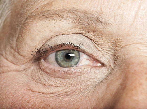 Close-up of a person's eye; light green iris, wrinkles around the eye, and light skin tone.
