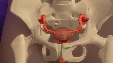 Endometriosis — Nashville, TN — Nashville Healthcare Center Endometriosis — Nashville, TN — Nashville Healthcare Center