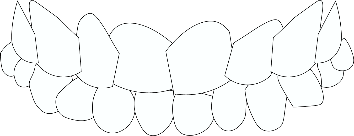 CROOKED TEETH
