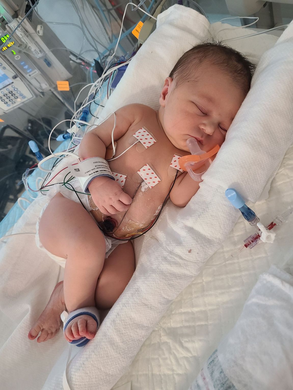 A newborn baby is sleeping in an incubator in a hospital.