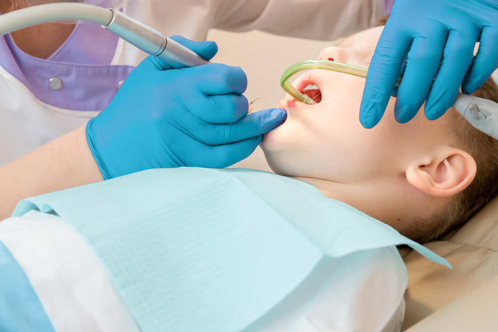 Safe Dental Sedation Method Safe Dental Sedation Method